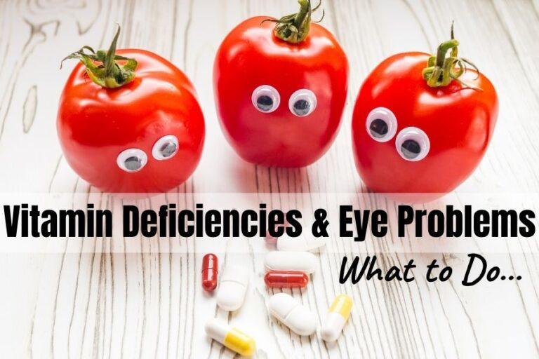5 Vitamin Deficiencies and Eye Problems What to Do...